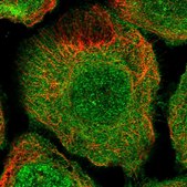 Anti-TBC1D9B antibody produced in rabbit Prestige Antibodies® Powered by Atlas Antibodies, affinity isolated antibody, buffered aqueous glycerol solution