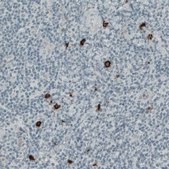 Monoclonal Anti-KIT antibody produced in mouse Prestige Antibodies® Powered by Atlas Antibodies, clone CL1667, purified immunoglobulin, buffered aqueous glycerol solution