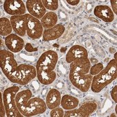 Anti-TNFRSF1B antibody produced in rabbit Prestige Antibodies® Powered by Atlas Antibodies, affinity isolated antibody, buffered aqueous glycerol solution