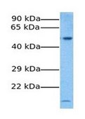 Anti-SLC41A1 antibody produced in rabbit affinity isolated antibody