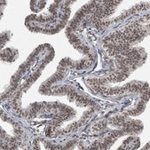 Anti-DDX42 antibody produced in rabbit Prestige Antibodies® Powered by Atlas Antibodies, affinity isolated antibody, buffered aqueous glycerol solution, Ab1