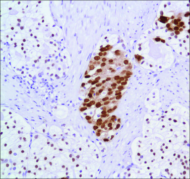 Anti-Androgen Receptor antibody, Rabbit monoclonal clone SP107, recombinant, expressed in proprietary host, affinity isolated antibody