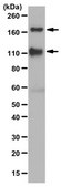 Anti-IGF-IR&#945; subunit Antibody from chicken, purified by affinity chromatography