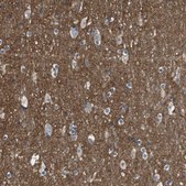 Anti-MYO18A antibody produced in rabbit Prestige Antibodies® Powered by Atlas Antibodies, affinity isolated antibody, buffered aqueous glycerol solution, Ab1