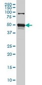 Monoclonal Anti-STK38 antibody produced in mouse clone 3A5, purified immunoglobulin, buffered aqueous solution