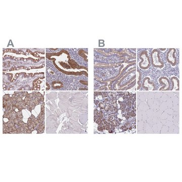 Anti-TMED10 antibody produced in rabbit Prestige Antibodies&#174; Powered by Atlas Antibodies, affinity isolated antibody, buffered aqueous glycerol solution