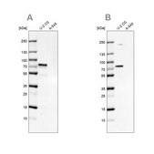 Anti-CXorf67 antibody produced in rabbit Prestige Antibodies® Powered by Atlas Antibodies, affinity isolated antibody, buffered aqueous glycerol solution
