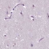Anti-ACY3 antibody produced in rabbit Prestige Antibodies® Powered by Atlas Antibodies, affinity isolated antibody, buffered aqueous glycerol solution