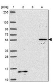 Anti-TBX15 antibody produced in rabbit Prestige Antibodies® Powered by Atlas Antibodies, affinity isolated antibody, buffered aqueous glycerol solution