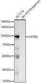 Anti-SATB2 Antibody, clone 3F9E1, Rabbit Monoclonal