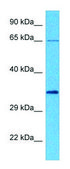 Anti-VGLL4 antibody produced in rabbit affinity isolated antibody