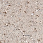 Anti-ALDH7A1 antibody produced in rabbit Prestige Antibodies® Powered by Atlas Antibodies, affinity isolated antibody, buffered aqueous glycerol solution