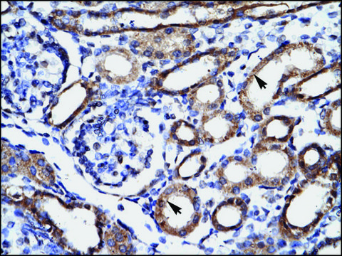 Anti-FHL1 antibody produced in rabbit IgG fraction of antiserum