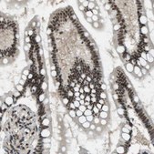 Anti-SP100 antibody produced in rabbit Prestige Antibodies® Powered by Atlas Antibodies, affinity isolated antibody, buffered aqueous glycerol solution