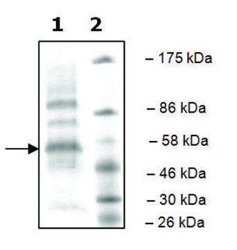 cKit active human recombinant, expressed in baculovirus infected Sf9 cells, &#8805;32% (SDS-PAGE)