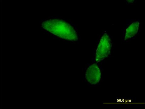 Anti-TMOD3 antibody produced in mouse purified immunoglobulin, buffered aqueous solution