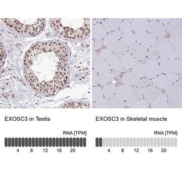 Anti-EXOSC3 antibody produced in rabbit Prestige Antibodies&#174; Powered by Atlas Antibodies, affinity isolated antibody, buffered aqueous glycerol solution