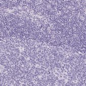 Anti-CLDN16 antibody produced in rabbit Prestige Antibodies® Powered by Atlas Antibodies, affinity isolated antibody, buffered aqueous glycerol solution
