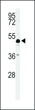 ANTI-ANKH(C-TERMINAL) antibody produced in rabbit affinity isolated antibody, buffered aqueous solution