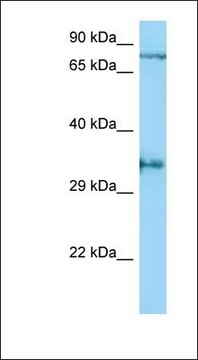 Anti-AQP4 antibody produced in rabbit affinity isolated antibody