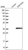 Anti-SDR16C5 antibody produced in rabbit Prestige Antibodies® Powered by Atlas Antibodies, affinity isolated antibody, buffered aqueous glycerol solution