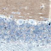 Monoclonal Anti-TSPAN7 antibody produced in mouse Prestige Antibodies® Powered by Atlas Antibodies, clone CL0265, purified immunoglobulin, buffered aqueous glycerol solution