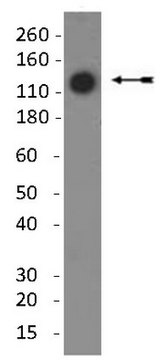 Anti-Collagen Type II Antibody, clone 6B3 clone 6B3, Chemicon&#174;, from mouse