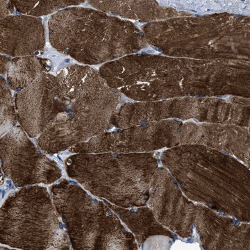 Anti-TRIM54 antibody produced in rabbit Prestige Antibodies&#174; Powered by Atlas Antibodies, affinity isolated antibody, buffered aqueous glycerol solution