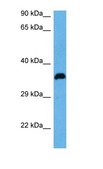 Anti-PIM1, (N-terminal) antibody produced in rabbit affinity isolated antibody