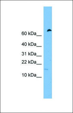 Anti-IFITM5 antibody produced in rabbit affinity isolated antibody