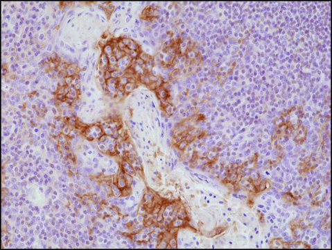 Anti-PD-L1antibody, Rabbit Monoclonal recombinant, expressed in HEK 293 cells, clone RM320, purified immunoglobulin