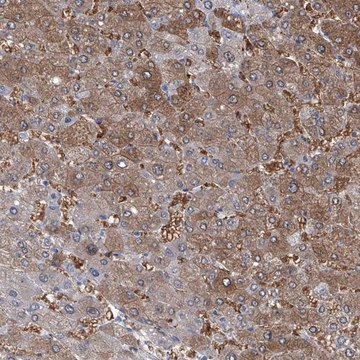 Anti-PFKL antibody produced in rabbit Prestige Antibodies&#174; Powered by Atlas Antibodies, affinity isolated antibody, buffered aqueous glycerol solution