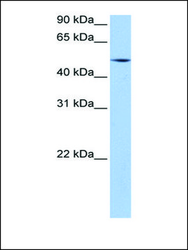 Anti-ESRRG antibody produced in rabbit affinity isolated antibody