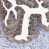 Anti-CCDC6 antibody produced in rabbit Prestige Antibodies® Powered by Atlas Antibodies, affinity isolated antibody, buffered aqueous glycerol solution, Ab2