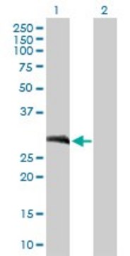 Anti-LOR antibody produced in mouse purified immunoglobulin, buffered aqueous solution