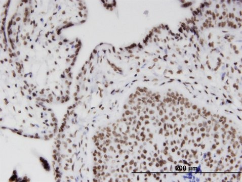 Monoclonal Anti-RIOK2, (C-terminal) antibody produced in mouse clone 1B10, purified immunoglobulin, buffered aqueous solution