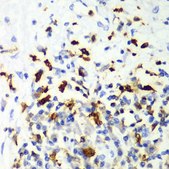 Anti-CAPG antibody produced in rabbit