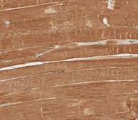 Anti-Dysferlin/DYSF Antibody, clone 10H3.1 clone 10H3.1, from mouse