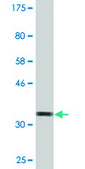 Monoclonal Anti-OMP antibody produced in mouse clone 2B7, purified immunoglobulin, buffered aqueous solution