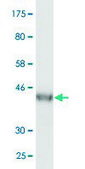 Monoclonal Anti-VPS25 antibody produced in mouse clone 4D6-2D4, purified immunoglobulin, buffered aqueous solution