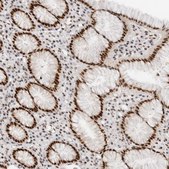 Anti-GTF2I antibody produced in rabbit affinity isolated antibody, buffered aqueous glycerol solution