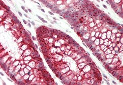 Anti-SLC39A5 (AB1) antibody produced in rabbit affinity isolated antibody