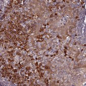 Anti-HN1L antibody produced in rabbit Prestige Antibodies® Powered by Atlas Antibodies, affinity isolated antibody, buffered aqueous glycerol solution