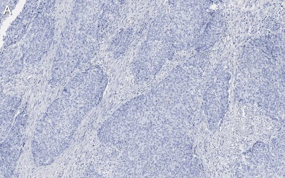 Anti-Integrin &#946;1 Antibody, clone 1A27 , ZooMAb&#174; Rabbit Monoclonal recombinant, expressed in HEK 293 cells