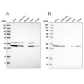 Anti-GLOD4 antibody produced in rabbit Prestige Antibodies® Powered by Atlas Antibodies, affinity isolated antibody, buffered aqueous glycerol solution, Ab3