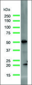 Anti-PTEN antibody, Rabbit monoclonal recombinant, expressed in proprietary host, clone SP170, affinity isolated antibody