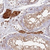 Anti-LACC1 antibody produced in rabbit Prestige Antibodies® Powered by Atlas Antibodies, affinity isolated antibody, buffered aqueous glycerol solution