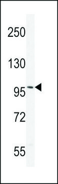 ANTI-ANDROGEN RECEPTOR (ANDR) antibody produced in rabbit affinity isolated antibody, buffered aqueous solution