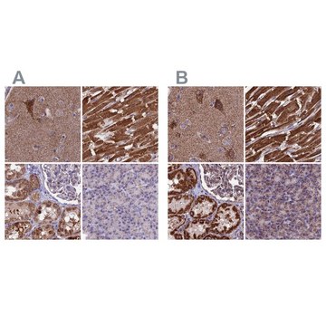 Anti-CS antibody produced in rabbit Prestige Antibodies&#174; Powered by Atlas Antibodies, affinity isolated antibody, buffered aqueous glycerol solution