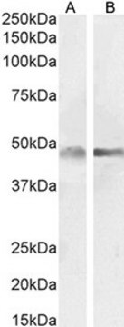 抗 GFAP 山羊抗 affinity isolated antibody, buffered aqueous solution